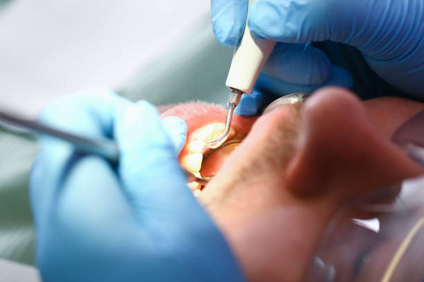 Best Weekend Emergency Dentist in Moorhead, MN