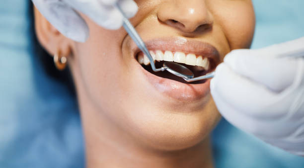 Best Emergency Tooth Extraction in Moorhead, MN